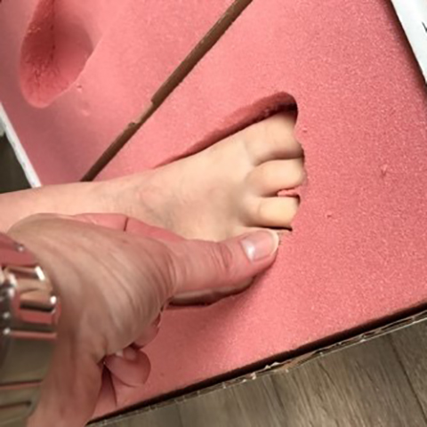 Orthotics Impression