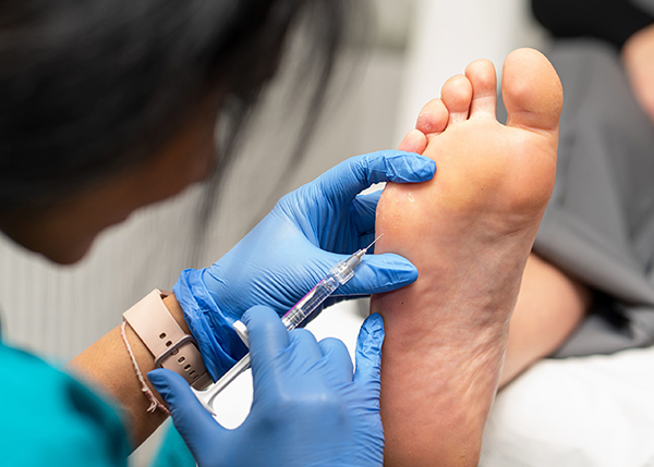 Dermal Foot Fillers